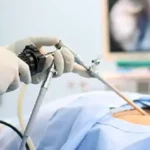 ഗർഭനിരോധന ശസ്ത്രക്രിയകൾ: ലാപ്രോസ്കോപ്പിക് രീതിയും ഓപ്പൺ സർജറിയും തമ്മിലുള്ള വ്യത്യാസങ്ങൾ..Contraceptive surgeries: Differences between laparoscopic and open surgery.