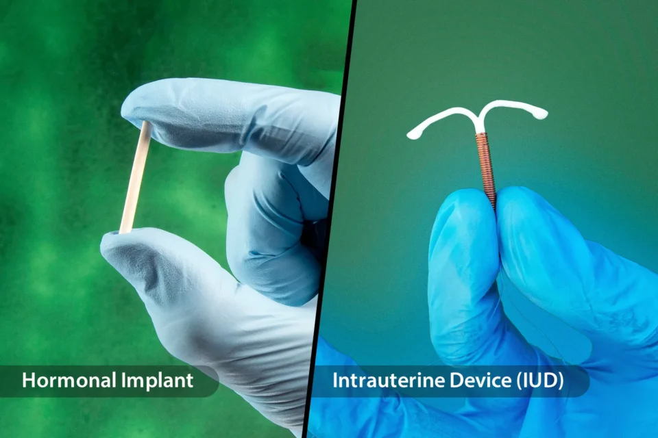കോപ്പർ ടി / ഇംപ്ലാന്റ്സ്: നിങ്ങൾക്ക് അനുയോജ്യമായ ദീർഘകാല ഗർഭനിരോധന മാർഗ്ഗം ഏതാണ്? Copper T/Implants: Which Long-Term Contraception Method is Right for You?