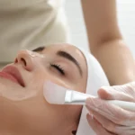 കെമിക്കൽ പീലിംഗും ലേസർ ചികിത്സയും: നിങ്ങളുടെ ചർമ്മത്തിന് അനുയോജ്യം ഏത്? Chemical Peeling vs. Laser Treatment: Which is Right for Your Skin?