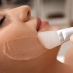 കെമിക്കൽ പീലിംഗ് (Chemical Peels) മുഖക്കുരു പാടുകൾ മാറ്റാൻ സഹായിക്കുന്നത് എങ്ങനെ? How do chemical peels help fade acne scars?