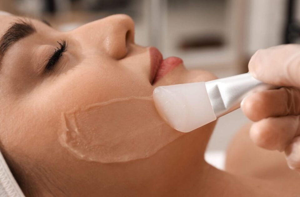 കെമിക്കൽ പീലിംഗ് (Chemical Peels) മുഖക്കുരു പാടുകൾ മാറ്റാൻ സഹായിക്കുന്നത് എങ്ങനെ? How do chemical peels help fade acne scars?